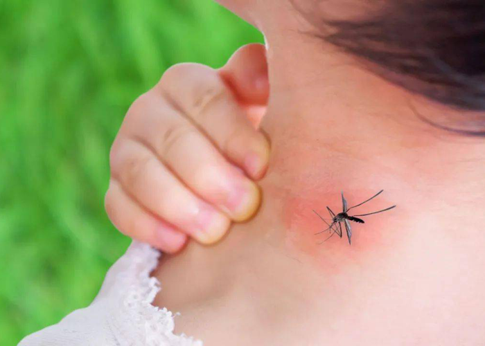守护儿童 默默无“蚊”——儿科防蚊虫叮咬攻略
